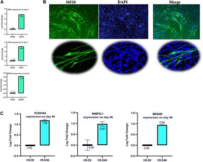 Involvement of N4BP2L1, PLEKHA4, and BEGAIN genes in breast cancer and muscle cell development